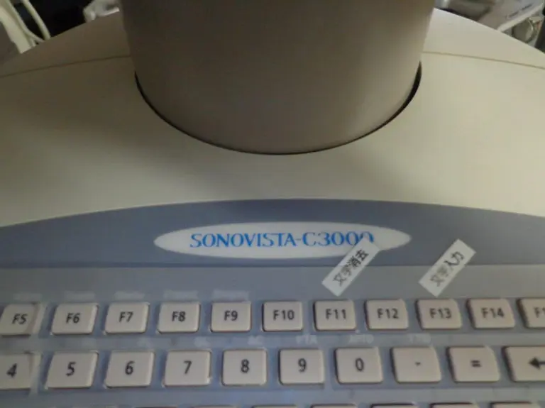Shimadzu Siemens Sonovista C3000, photo 4