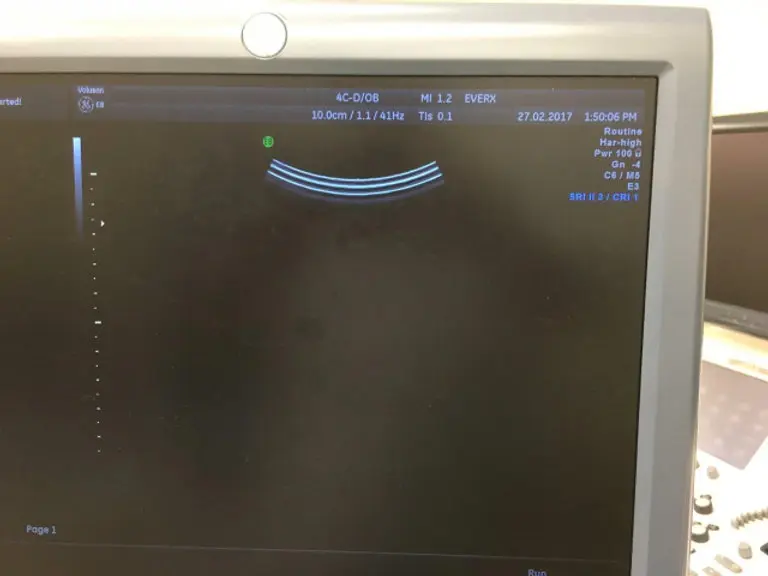 2008 GE Voluson E8 Expert, photo 3