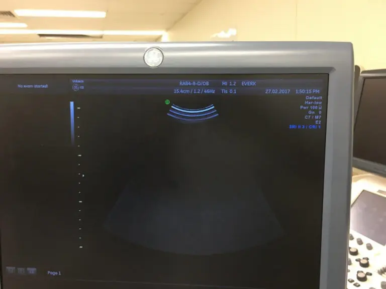 2008 GE Voluson E8 Expert, photo 4