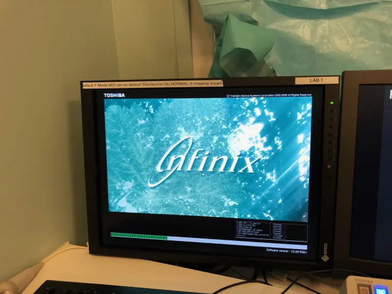 2008 Toshiba Infinix 8000D Cardiac, photo 2