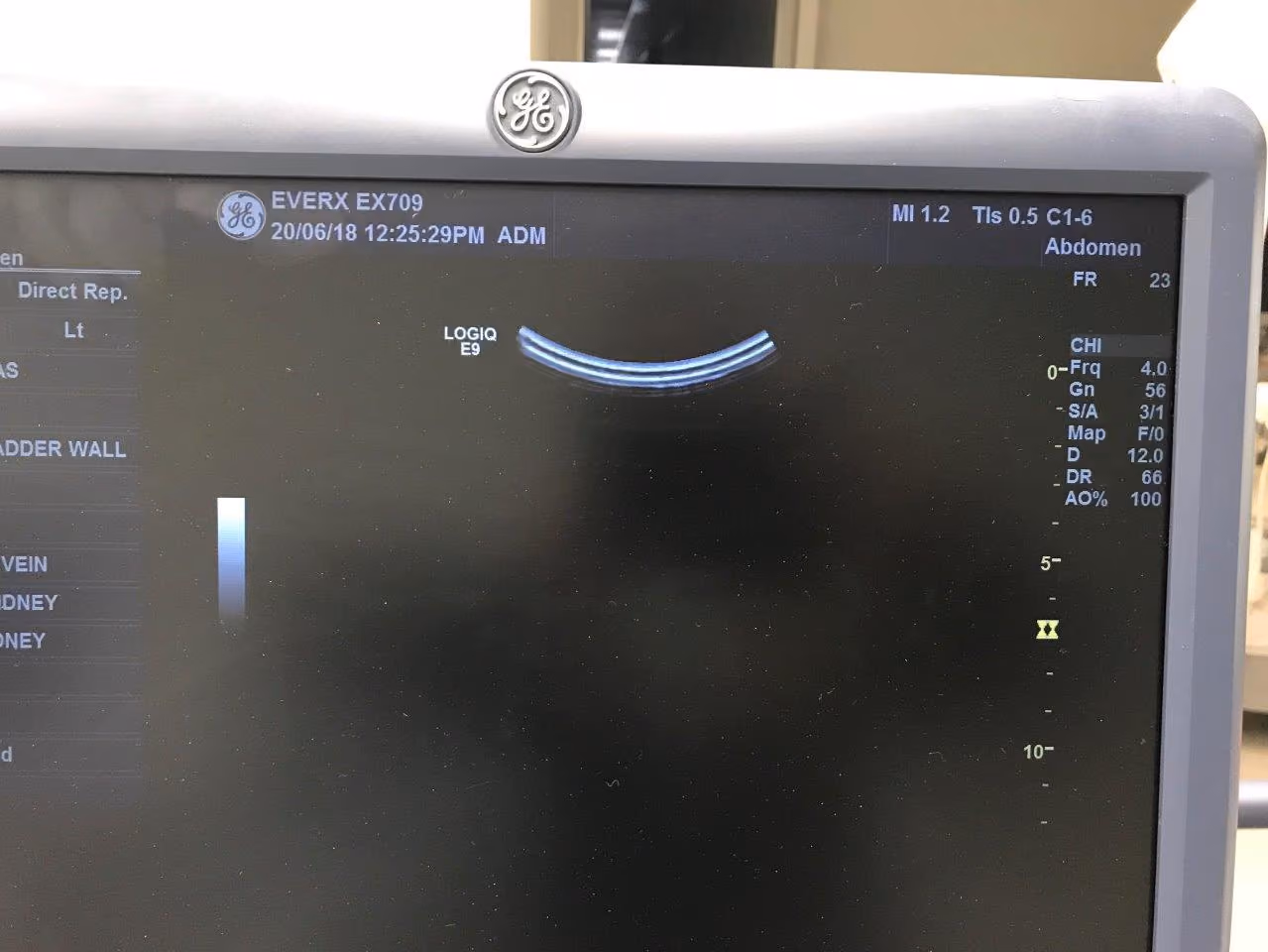2013 GE Logiq E9 with 4D, photo 6