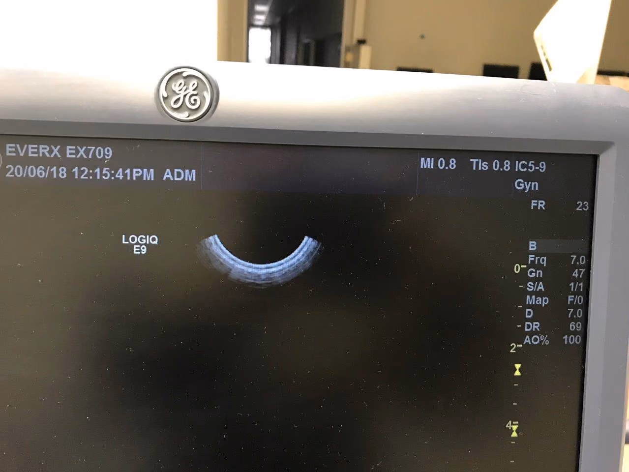2013 GE Logiq E9 with 4D, photo 9