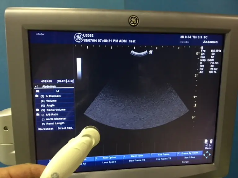 2010 GE Logiq P5, photo 4