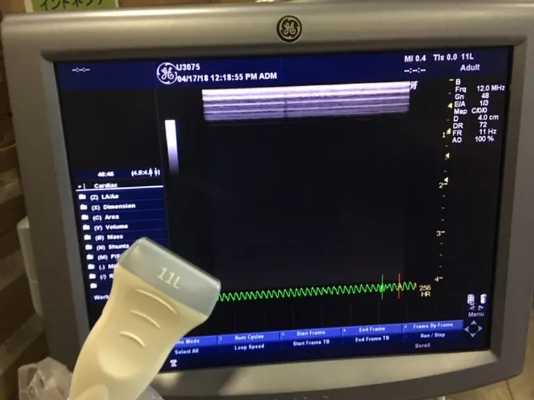 2013 GE Logiq P5, photo 3