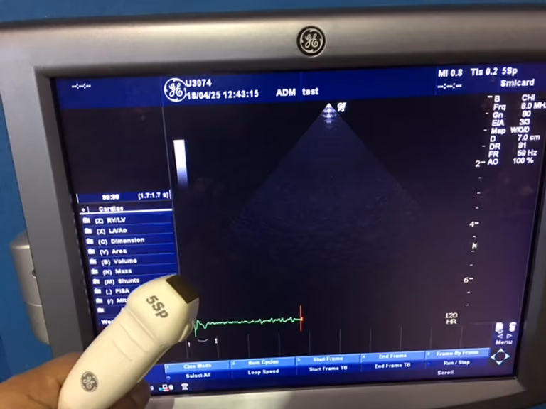 2012 GE Logiq P5, photo 5