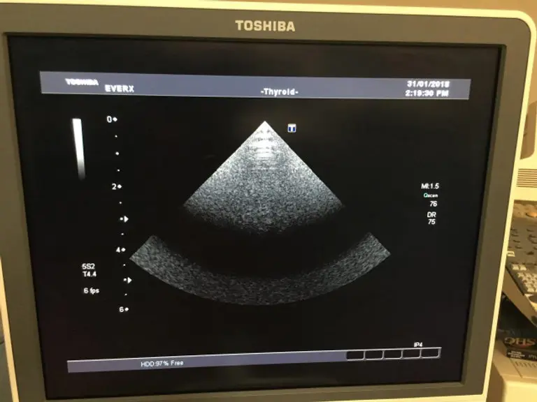 2010 Toshiba Aplio XG, photo 2