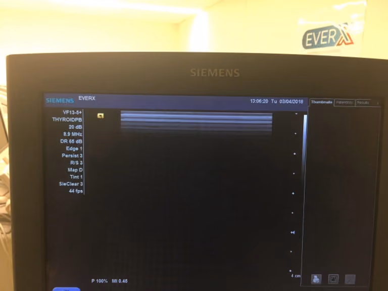 2010 Siemens Acuson X300, photo 6