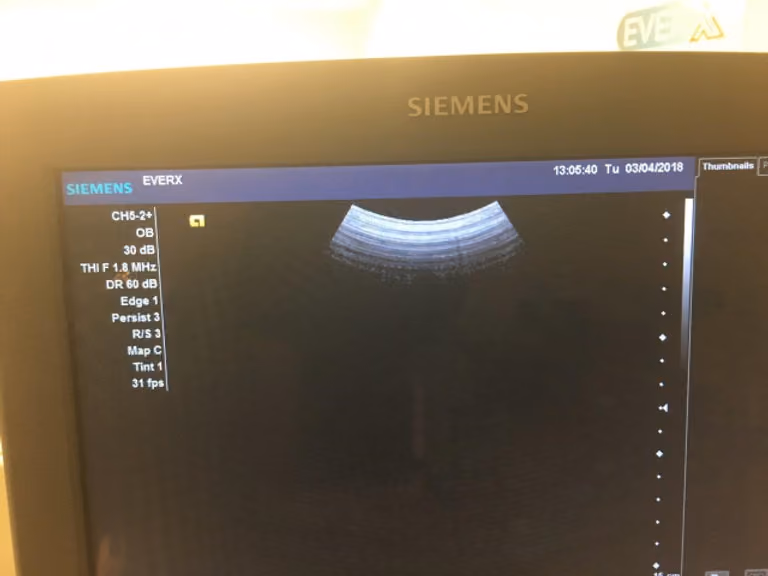2010 Siemens Acuson X300, photo 7
