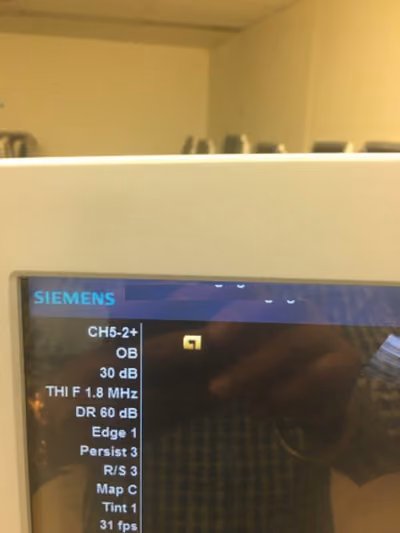 2010 Siemens Acuson X300, photo 8
