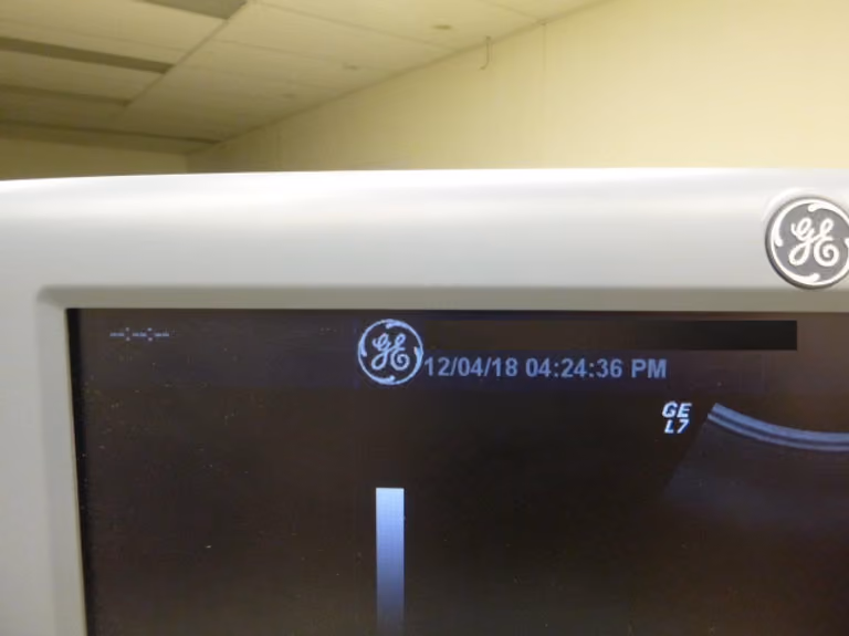 2008 GE Logiq 7_BT07, photo 6
