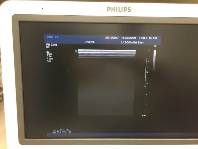 2009 Philips iU 22 Cart F.3, photo 4