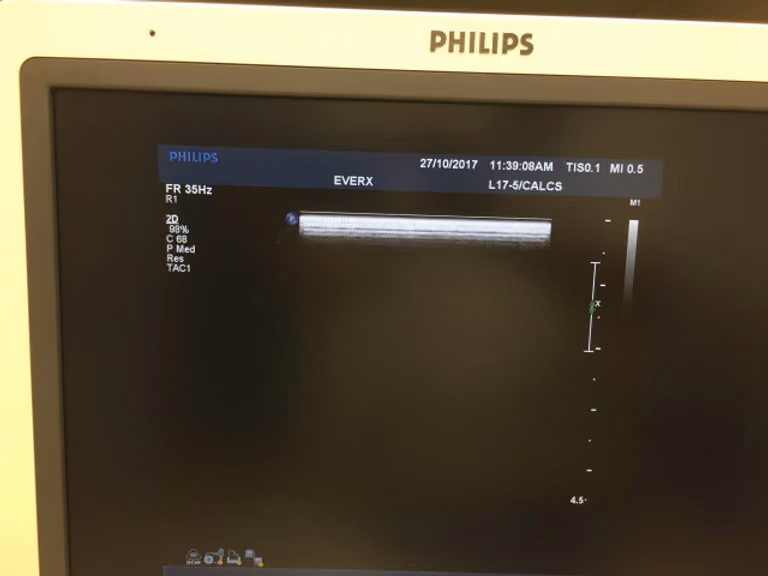 2009 Philips iU 22 Cart F.3, photo 5