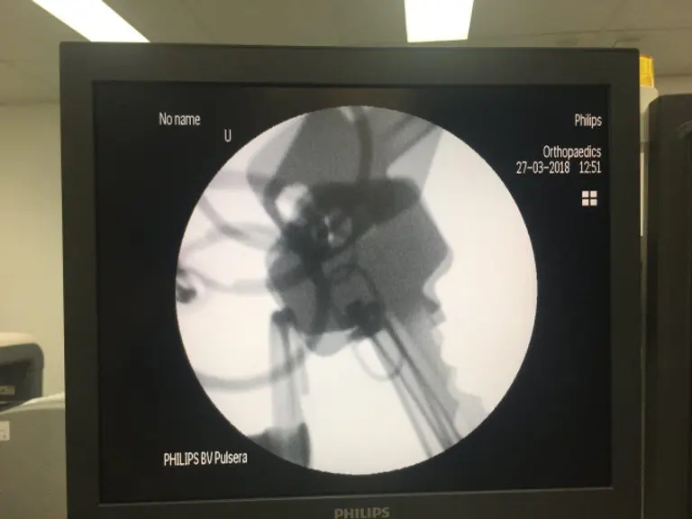 2005 Philips BV Pulsera Mobile C-Arm, photo 3