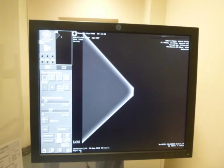 2009 GE Senographe Essentials – Digital Mammography unit, photo 2