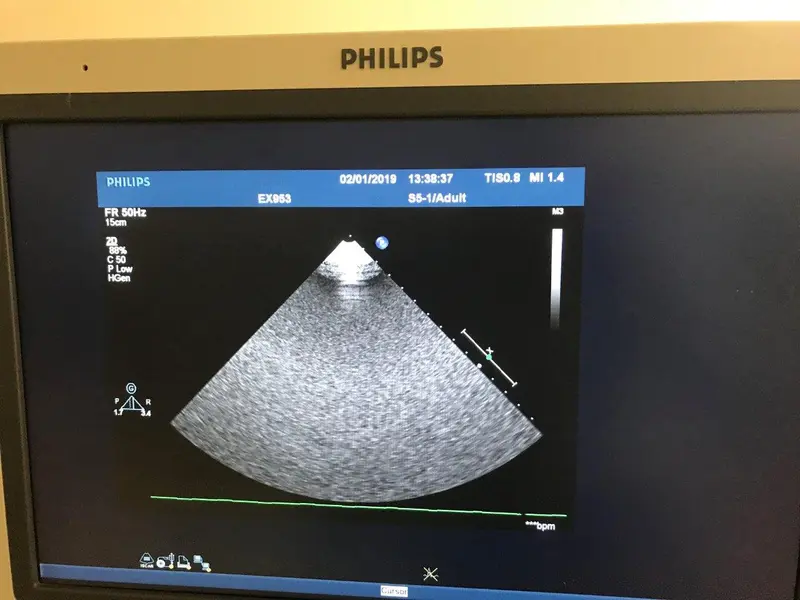 2011 Philips iE33 Cart G.1, photo 4