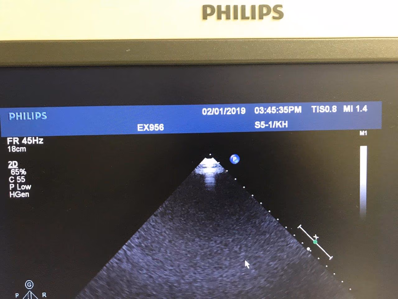 2011 Philips iE33 Cart G.1, photo 5