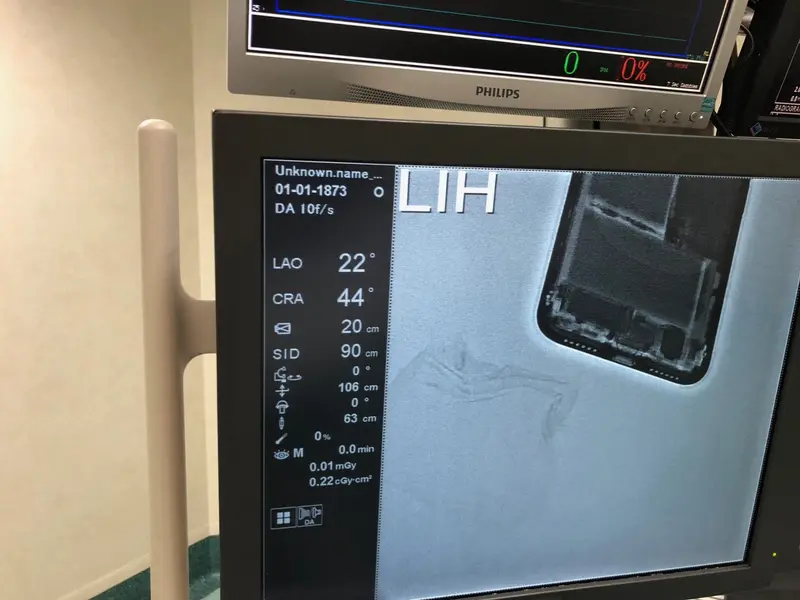 2009 Toshiba Infinix 8000D Cathlab, photo 4