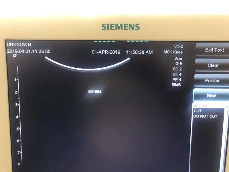2015 Siemens Acuson Freestyle, photo 4
