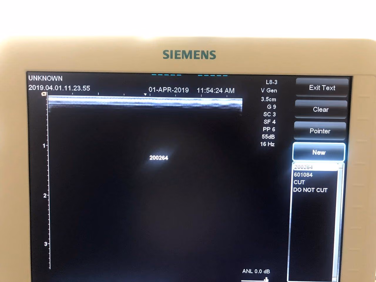 2015 Siemens Acuson Freestyle, photo 5