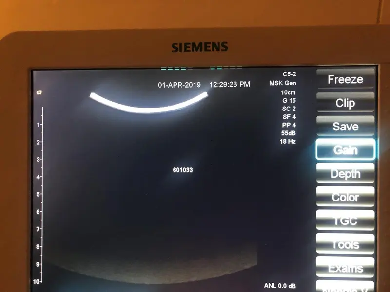 2015 Siemens Acuson Freestyle, photo 3