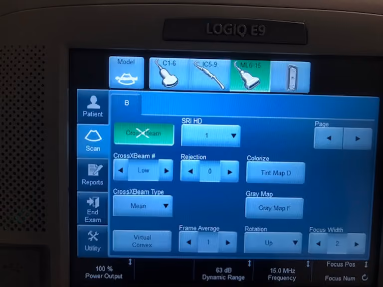 2013 GE Logiq E9, photo 5