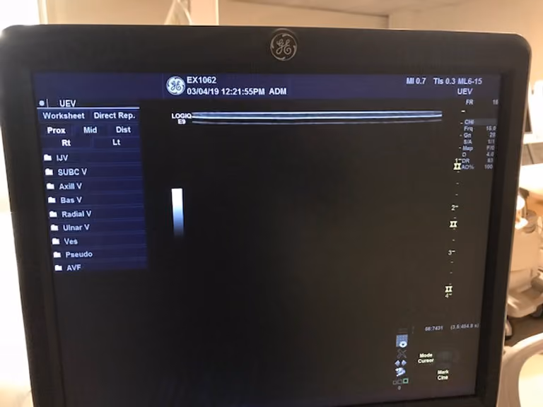2013 GE Logiq E9, photo 7