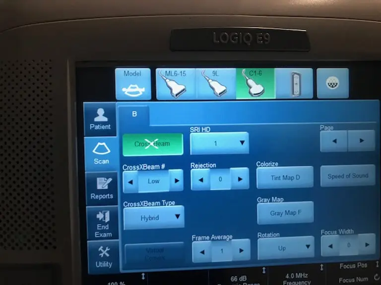 2013 GE Logiq E9, photo 4