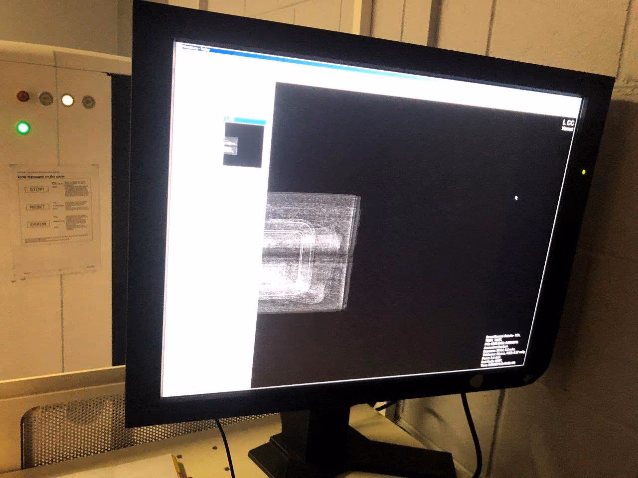 2010 Philips Sectra L30 Digital Mammography, photo 5