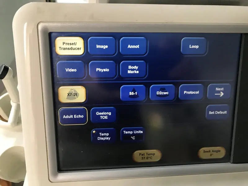 2012 Philips iE33 Cart G.1, photo 4