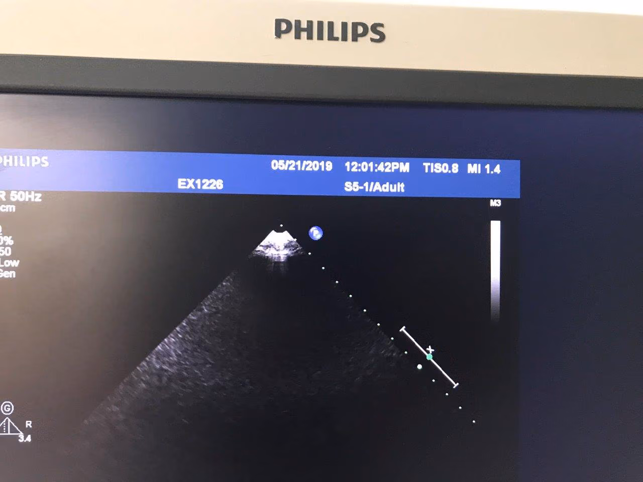 2012 Philips iE33 Cart G.1, photo 8