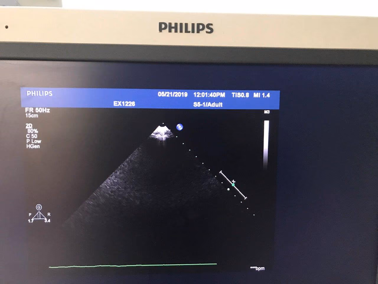 2012 Philips iE33 Cart G.1, photo 10