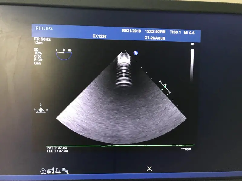 Philips X7-2t TEE, photo 2