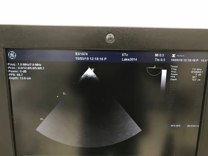 2013 GE 6Tc TEE Probe, photo 4