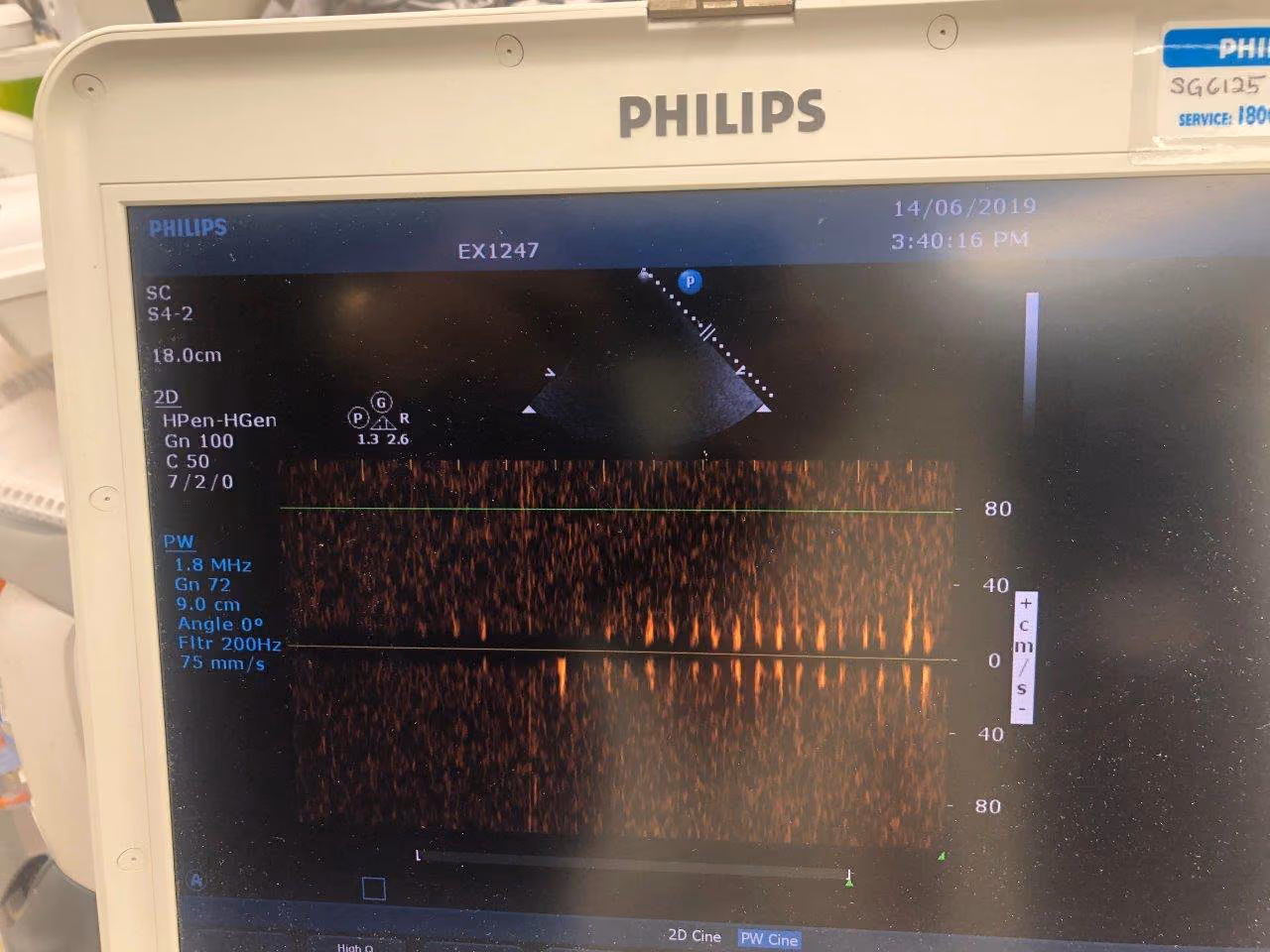 2012 Philips CX 30, photo 5