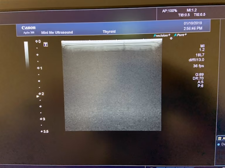 2018 Canon Aplio 300 with 4D, photo 6