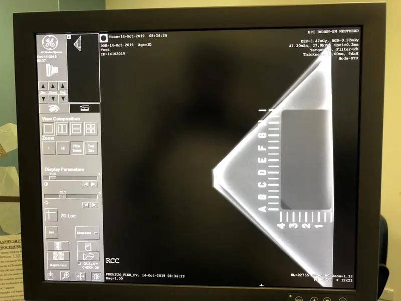 2006 GE Seno DS Digital Mammography, photo 4