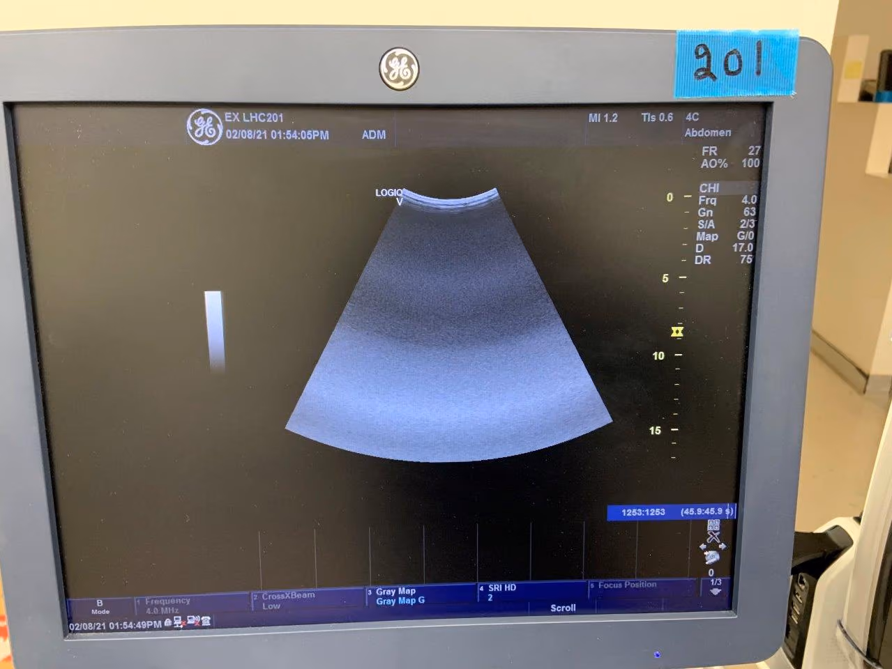 2019 GE Logiq V5, photo 5
