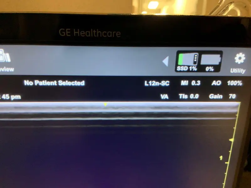 2018 GE Venue 50 Point of Care, photo 3