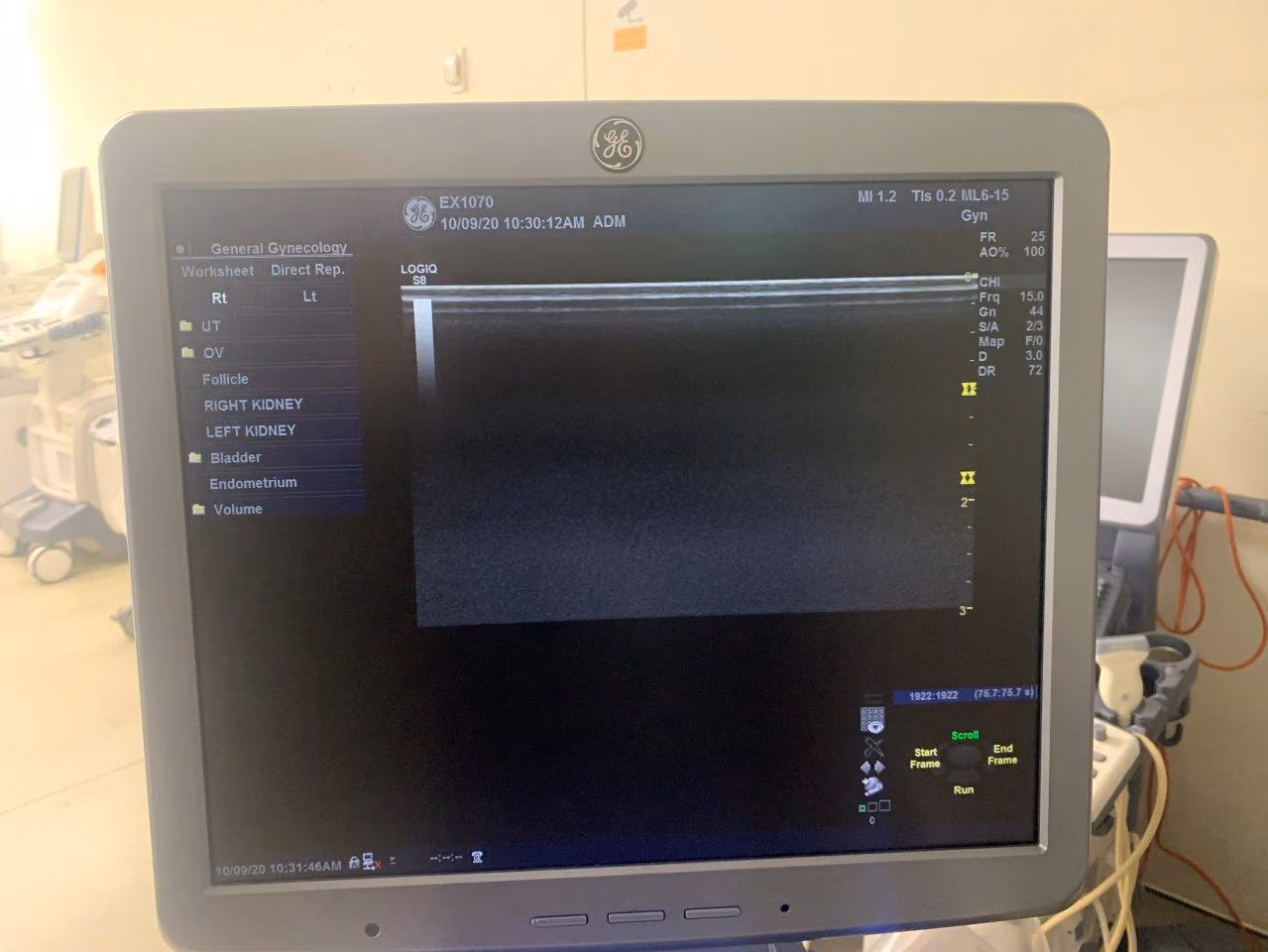 2013 GE Logiq S8, photo 5