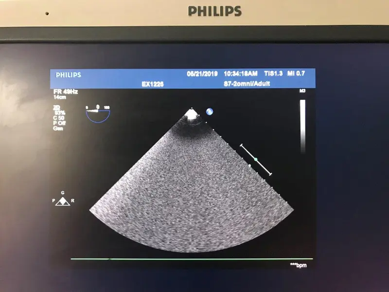 2000 Philips S7-2 omni, photo 2