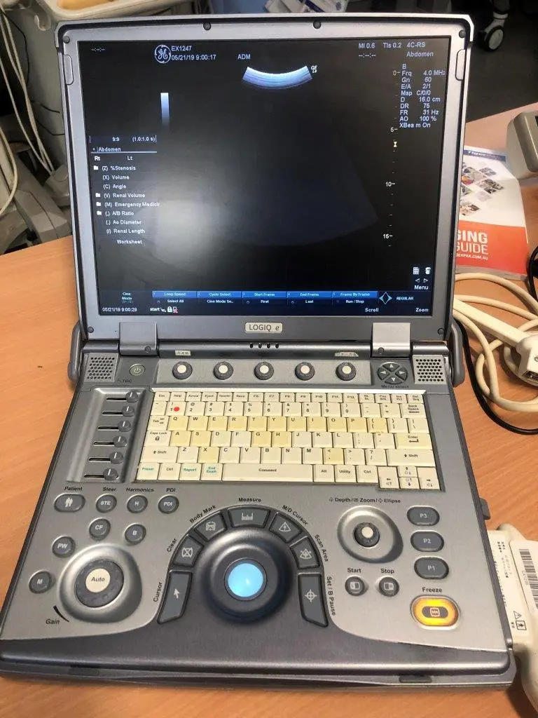 2009 GE Logiq e, photo 2