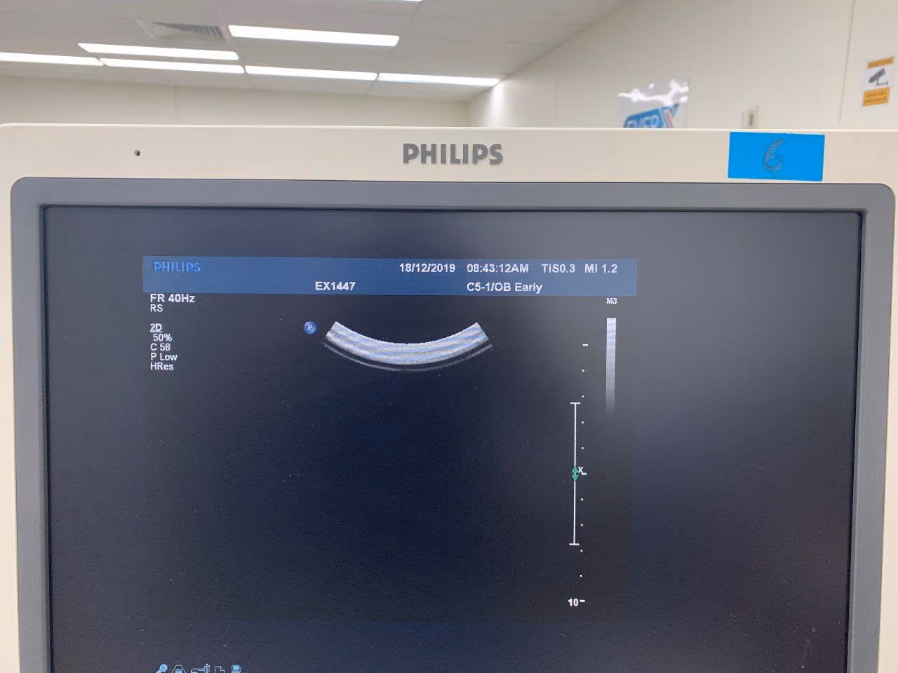 2011 Philips IU 22 Cart G.1, photo 6