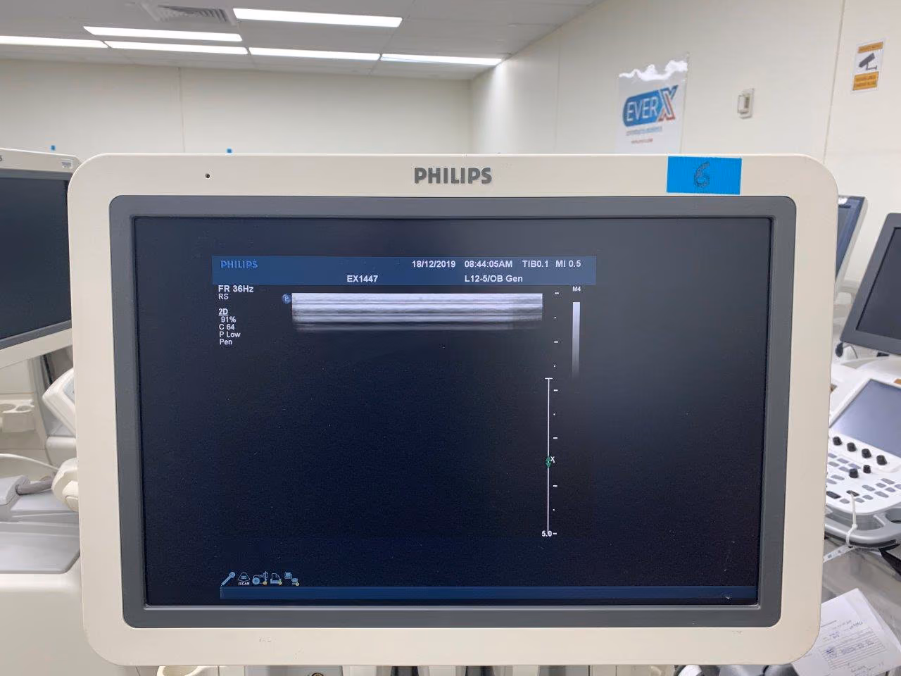 2011 Philips IU 22 Cart G.1, photo 7