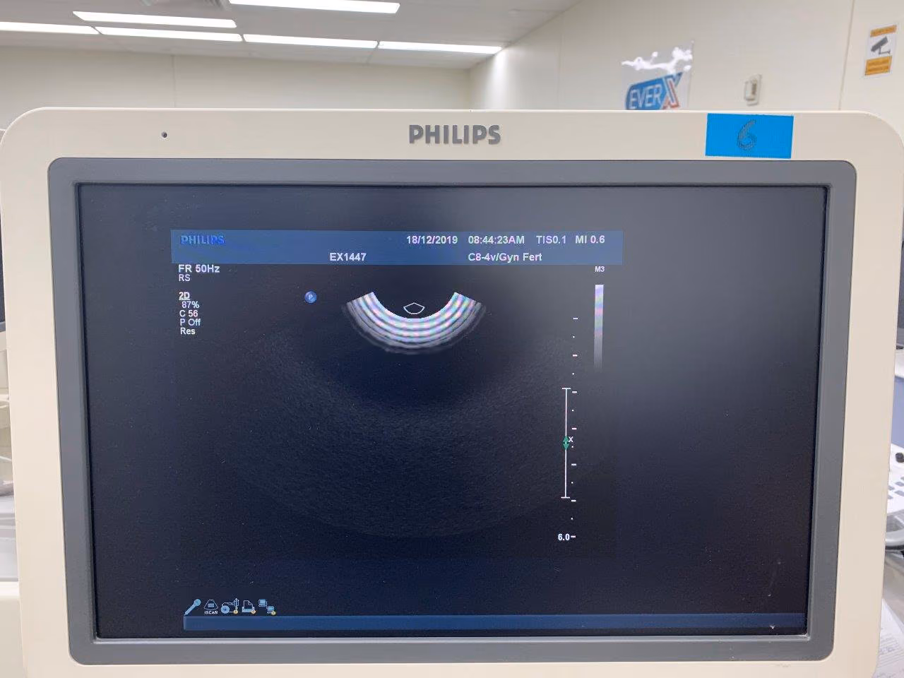 2011 Philips IU 22 Cart G.1, photo 8