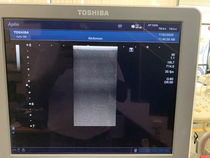 2012 Toshiba Aplio 300, photo 4