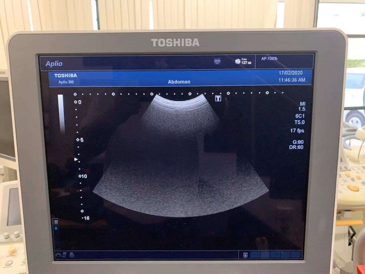 2012 Toshiba Aplio 300, photo 5