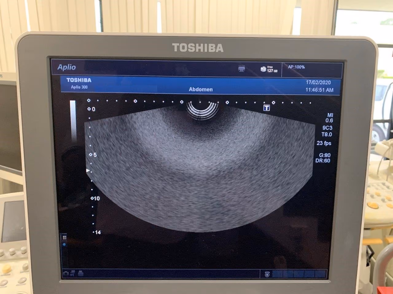 2012 Toshiba Aplio 300, photo 6