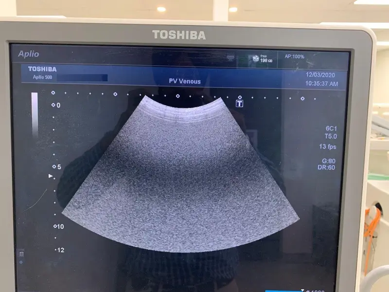 2013 Toshiba Aplio 500, photo 3