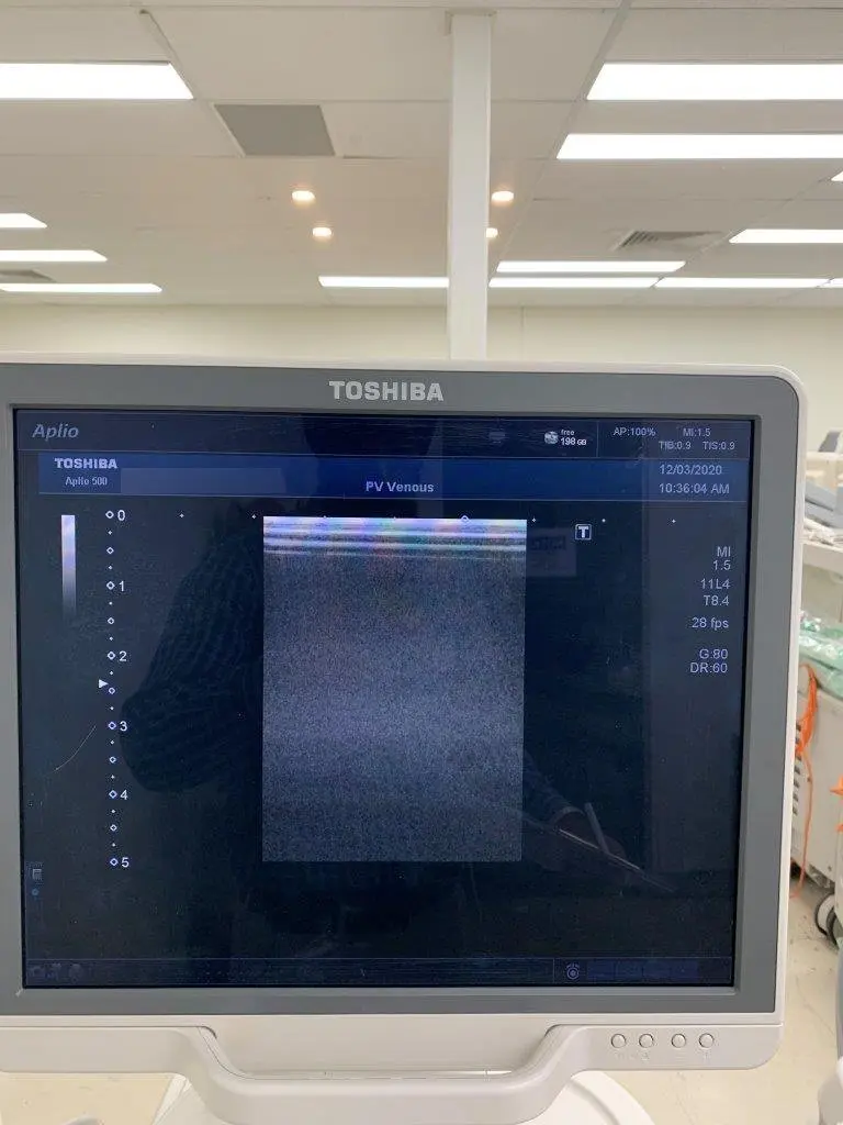 2013 Toshiba Aplio 500, photo 4