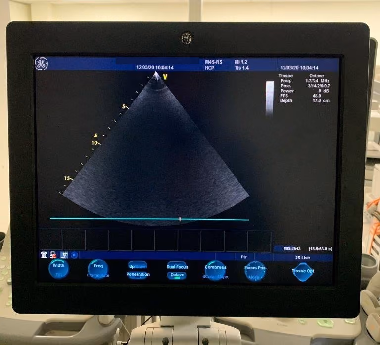 2008 GE Vivid S6 Cardiac, photo 6